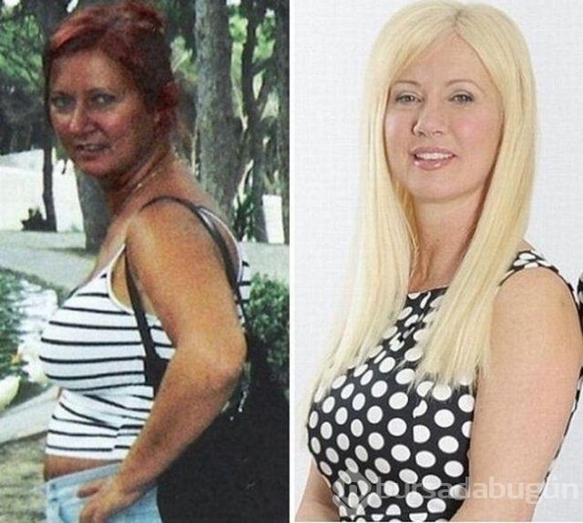En gereksiz estetik ameliyatlar 