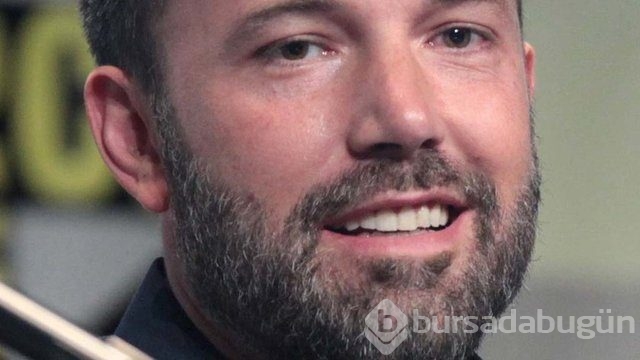 Gülümsemesini estetiğe borçlu ünlüler!