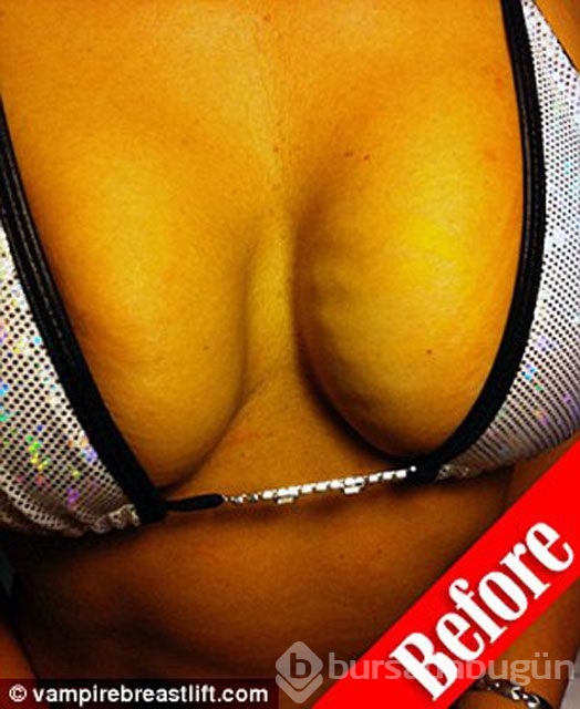 Daha seksi göğüs için bunu yapıyor