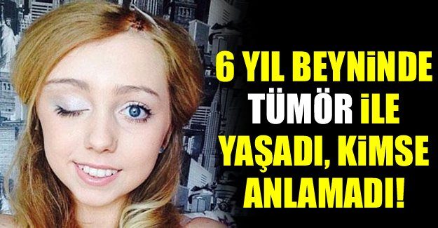 6 yıl beyninde tümör ile yaşadı kimse anlamadı
