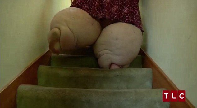 Cinsel ilişkiye girmeleri imkansız