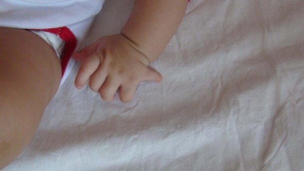 24 parmaklı bebek!