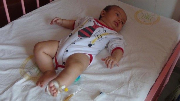24 parmaklı bebek!