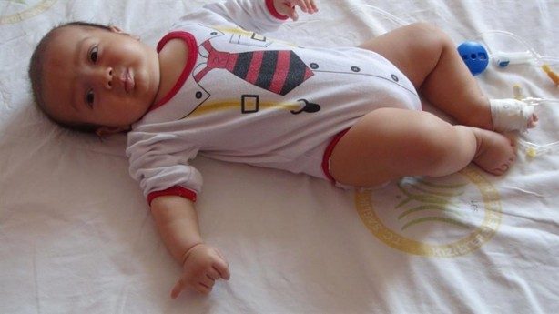 24 parmaklı bebek!