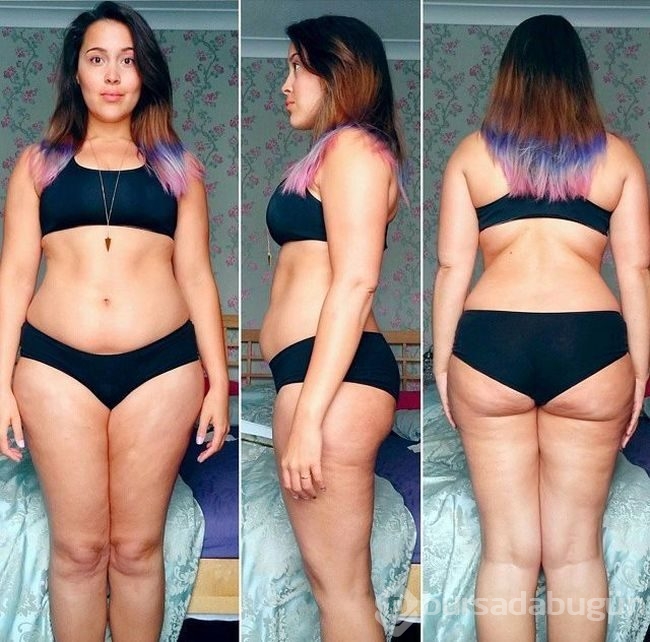 Anoreksiyadan kurtulan 22 yaşındaki Megan Jayne