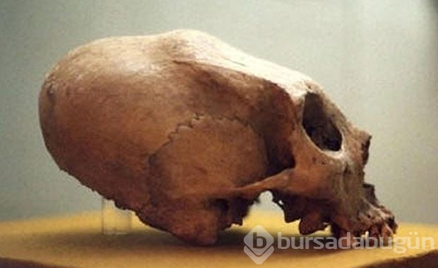 Bebeklikten itibaren başlıyorlar, Öyle bir nedeni var ki..