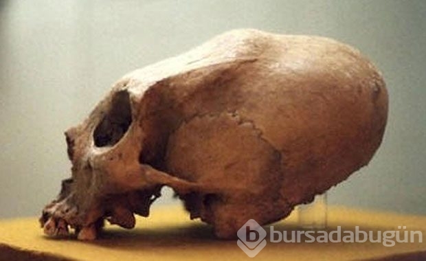 Bebeklikten itibaren başlıyorlar, Öyle bir nedeni var ki..