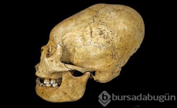 Bebeklikten itibaren başlıyorlar, Öyle bir nedeni var ki..