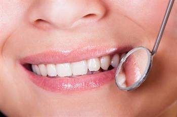 Bunu yapın dişlerinizin sararmasını engelleyin
