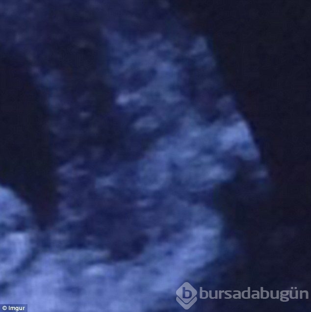 Ultrasonda korkutan görüntü!