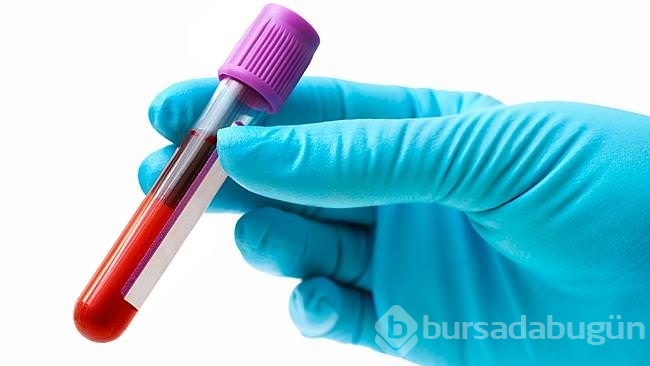 Türk bilimciler yerli yapay kan üretti	