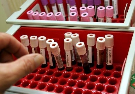 Türk bilimciler yerli yapay kan üretti	