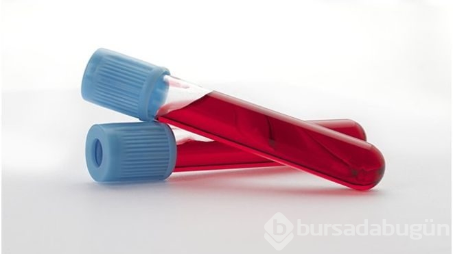 Türk bilimciler yerli yapay kan üretti	