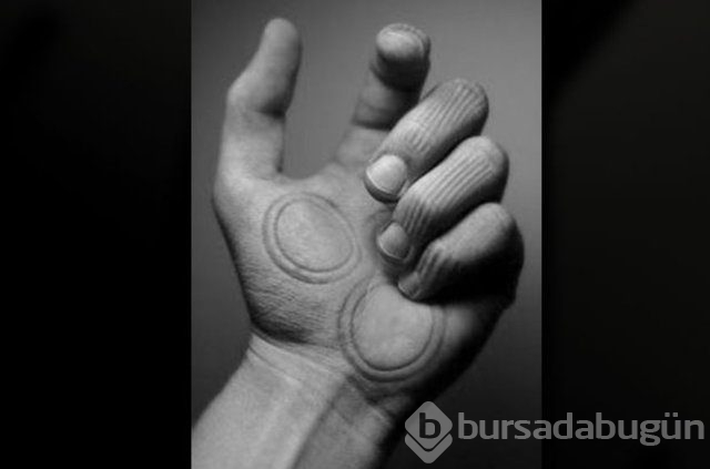 İşte giydiklerimizin vücudumuzda bıraktığı izler...
