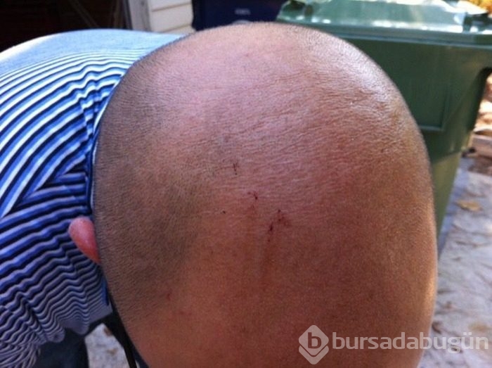 Dehşete düşüren görüntü