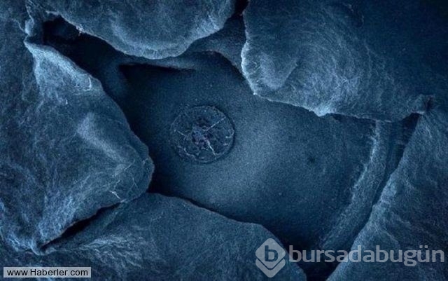 Her gün yediğimiz yemeklerin mikroskop altındaki görüntüleri