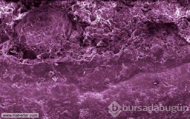 Her gün yediğimiz yemeklerin mikroskop altındaki görüntüleri