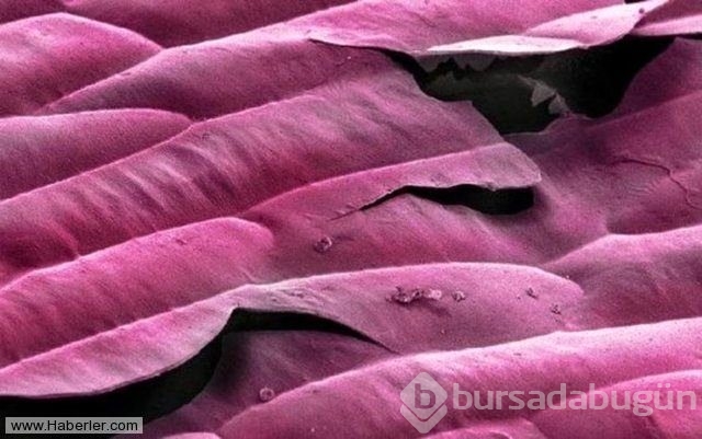 Her gün yediğimiz yemeklerin mikroskop altındaki görüntüleri
