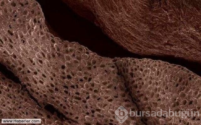 Her gün yediğimiz yemeklerin mikroskop altındaki görüntüleri