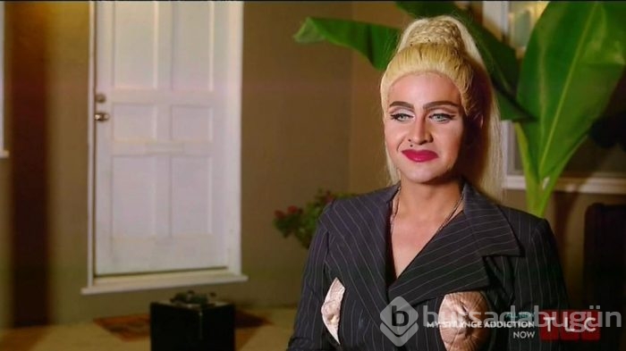 Madonna'ya benzemek için bunları yaptı!
