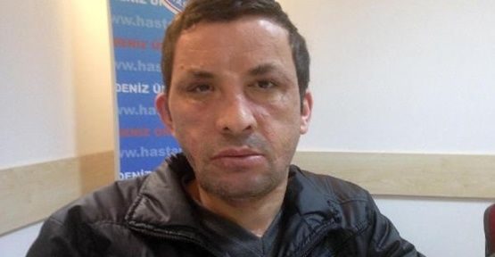 İlk yüz nakilli Uğur Acar hastaneye kaldırıldı	
