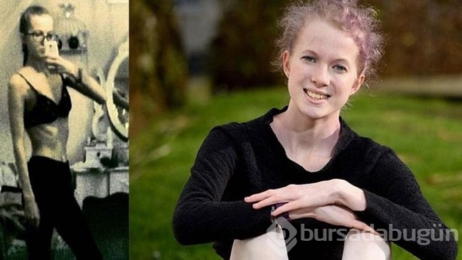 Günde 50 kaloriyle yaşıyordu