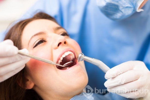 20 yaş dişleri ne zaman çekilmeli?