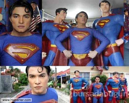 Superman'e benzemek için 23 kez operasyon geçirdi