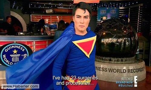 Superman'e benzemek için 23 kez operasyon geçirdi