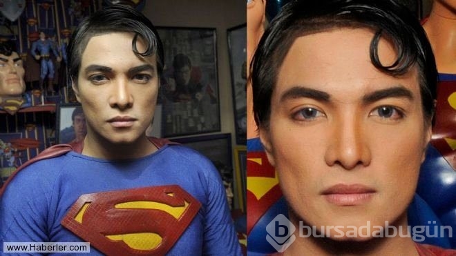 Superman'e benzemek için 23 kez operasyon geçirdi