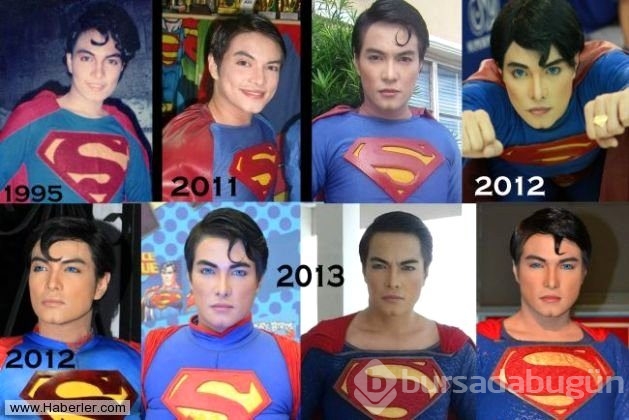 Superman'e benzemek için 23 kez operasyon geçirdi