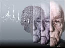 Alzheimer'dan korunmak için bunları yapın
