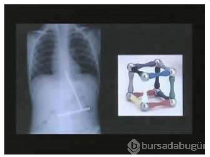İnsan midesinden çıkartılan en korkunç şeyler