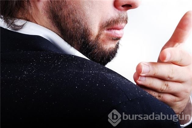 Kepekten kurtulmanın doğal yolları	
