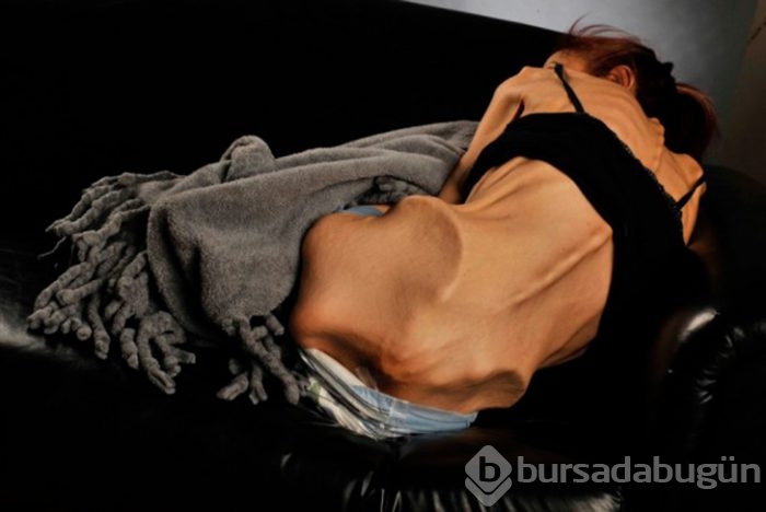 Her gün biraz daha zayıfladı