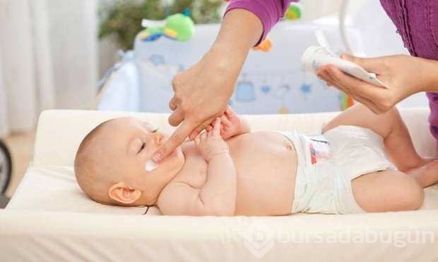 Bebeklerdeki yanıklara yoğurt sürmeyin!