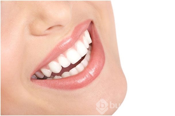 Bonding nedir?