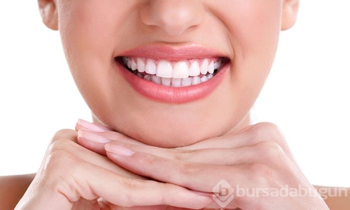 Bonding nedir?