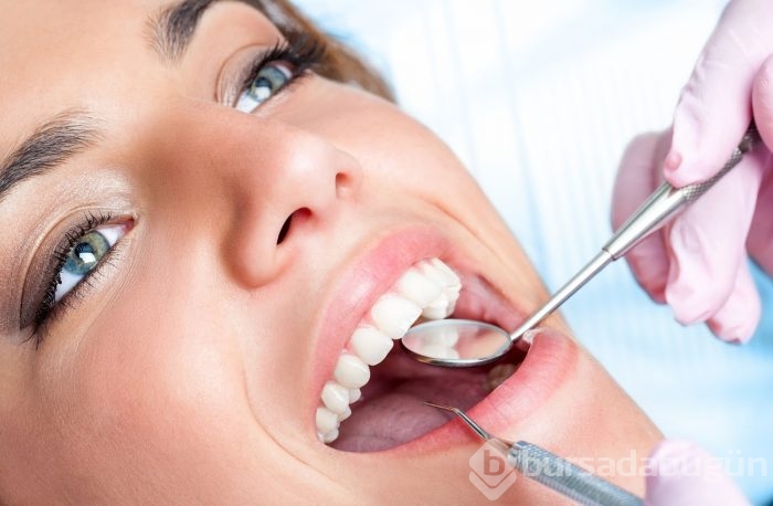 Bonding nedir?