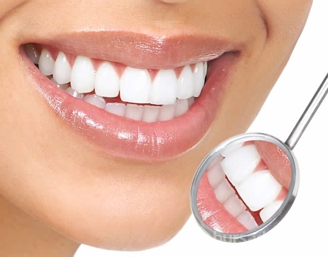 Bonding nedir?