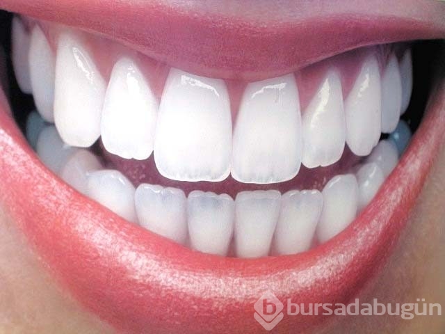 Bonding nedir?