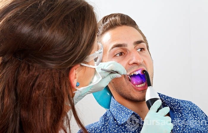 Bonding nedir?