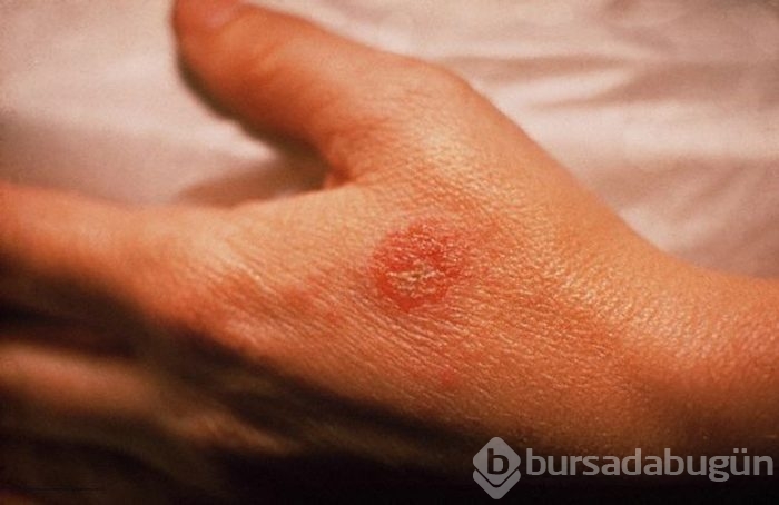 Bu öneri çok tartışılacak: Haftada bir kez duş alın, çünkü...