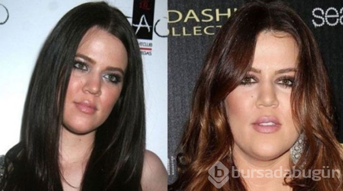 Kardashian yüzünü kaybetti 