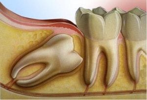 İnsanda bulunan 10 körelmiş organ