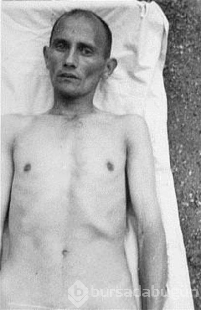 Korkunç Nazi deneyleri