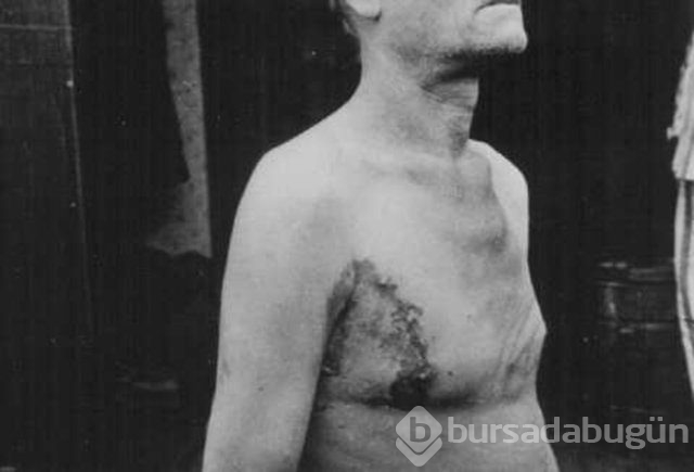 Korkunç Nazi deneyleri