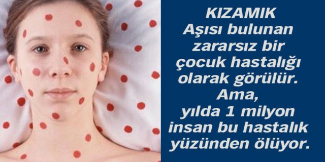 Dünyanı en beter hastalıkları