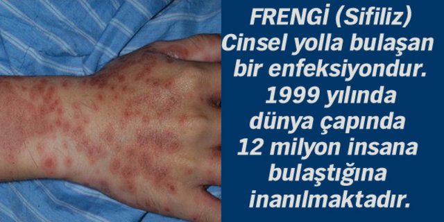 Dünyanı en beter hastalıkları