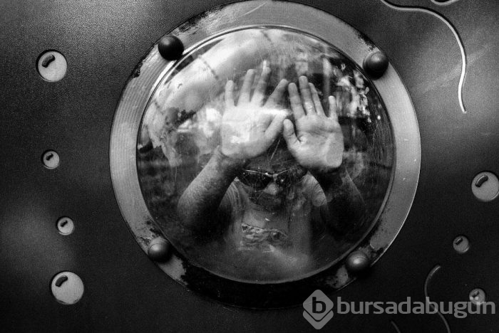 Şimdiye kadar 9 kişide görüldü!	
